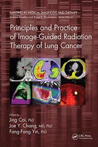 Principles and Practice of Image-Guided Radiation Therapy of Lung Cancer