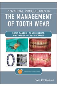 Practical Procedures in the Management of Tooth Wear