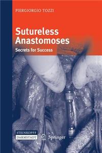 Sutureless Anastomoses