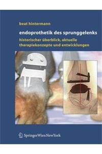 Endoprothetik Des Sprunggelenks