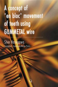 A Concept of En Bloc Movement of Teeth Using Gummetal Wire