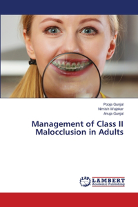 Management of Class II Malocclusion in Adults