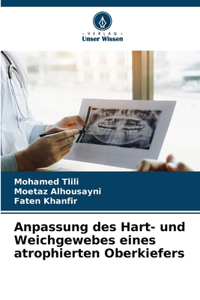 Anpassung des Hart- und Weichgewebes eines atrophierten Oberkiefers