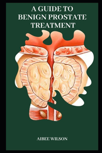 Guide to Benign Prostate Treatment