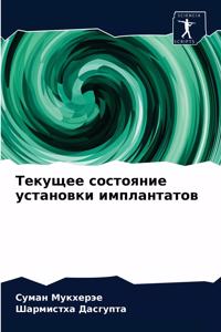 Текущее состояние установки имплантатов