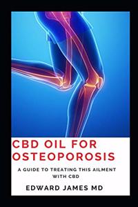 CBD Oil for Osteoporosis: A guide to treating this ailment with CBD