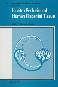 In vitro Perfusion of Human Placental Tissue