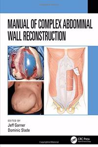 Manual of Complex Abdominal Wall Reconstruction