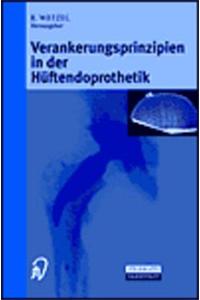 Verankerungsprinzipien in Der Ha1/4ftendoprothetik