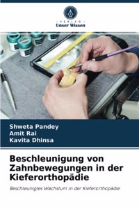 Beschleunigung von Zahnbewegungen in der Kieferorthopädie