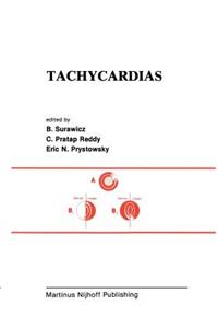 Tachycardias