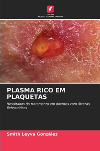 Plasma Rico Em Plaquetas