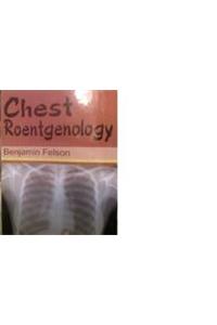 Chest Roentgenology