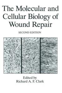 Molecular and Cellular Biology of Wound Repair