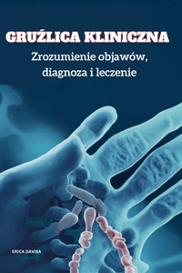 Gruźlica kliniczna