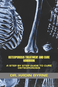 Osteoporosis Treatment and Cure Handbook