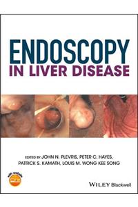 Endoscopy in Liver Disease