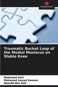 Traumatic Bucket Loop of the Medial Meniscus on Stable Knee