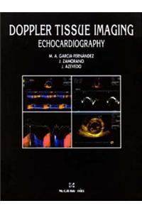 Doppler Tissue Imaging