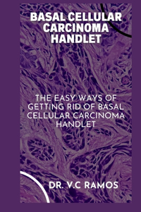 Basal Cellular Carcinoma Handlet