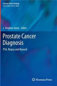 Prostate Cancer Diagnosis