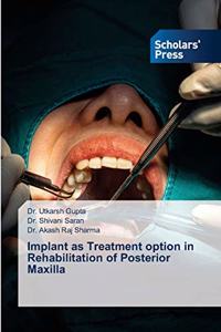 Implant as Treatment option in Rehabilitation of Posterior Maxilla