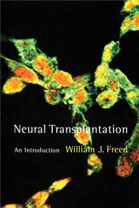 Neural Transplantation: An Introduction