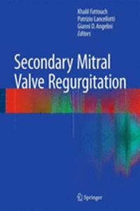 Secondary Mitral Valve Regurgitation