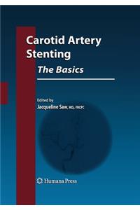 Carotid Artery Stenting: The Basics