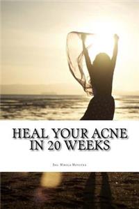 Heal your acne in 20 weeks