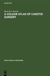 Colour Atlas of Carotid Surgery