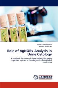 Role of Agnors' Analysis in Urine Cytology