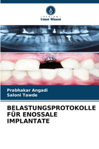 Belastungsprotokolle Für Enossale Implantate