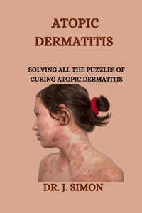 Atopic Dermatitis