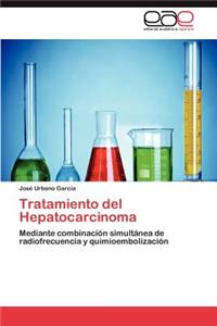 Tratamiento del Hepatocarcinoma