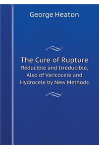 The Cure of Rupture Reducible and Irreducible, Also of Varicocele and Hydrocele by New Methods