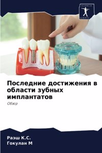 Последние достижения в области зубных имп