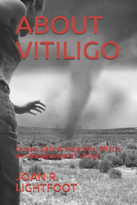 About Vitiligo