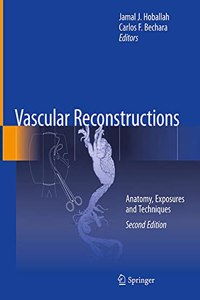 Vascular Reconstructions