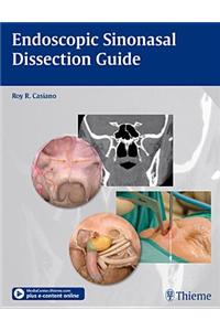 Endoscopic Sinonasal Dissection Guide