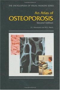 An Atlas of Osteoporosis, Second Edition