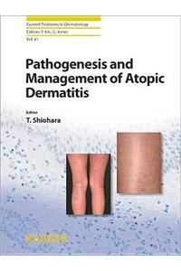 Pathogenesis and Management of Atopic Dermatitis