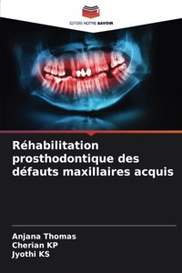 Réhabilitation prosthodontique des défauts maxillaires acquis