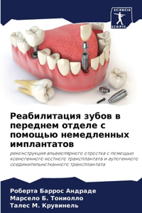 Реабилитация зубов в переднем отделе с поl