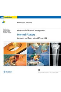 Ao Manual Of Fracture Management Internal Fixators