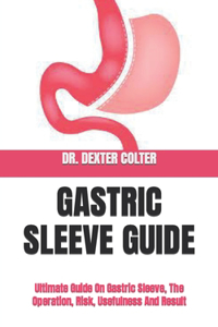 Gastric Sleeve Guide