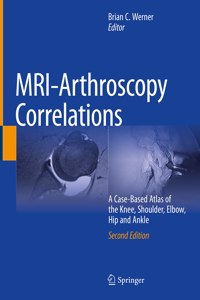 Mri-Arthroscopy Correlations