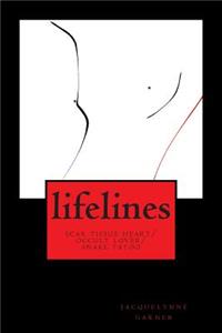 lifelines