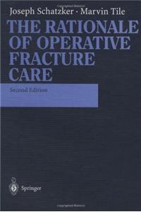 The Rationale of Operative Fracture Care