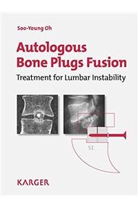 Autologous Bone Plugs Fusion: Treatment for Lumbar Instability: 3E Criteria/ Technical Operative Notes/ The Functioning of the Oh's Screw